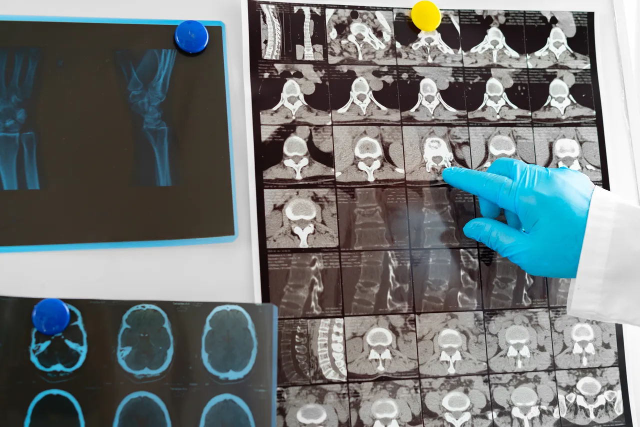 Non aspettare che sia troppo tardi: ecco gli esami di screening essenziali e quando farli